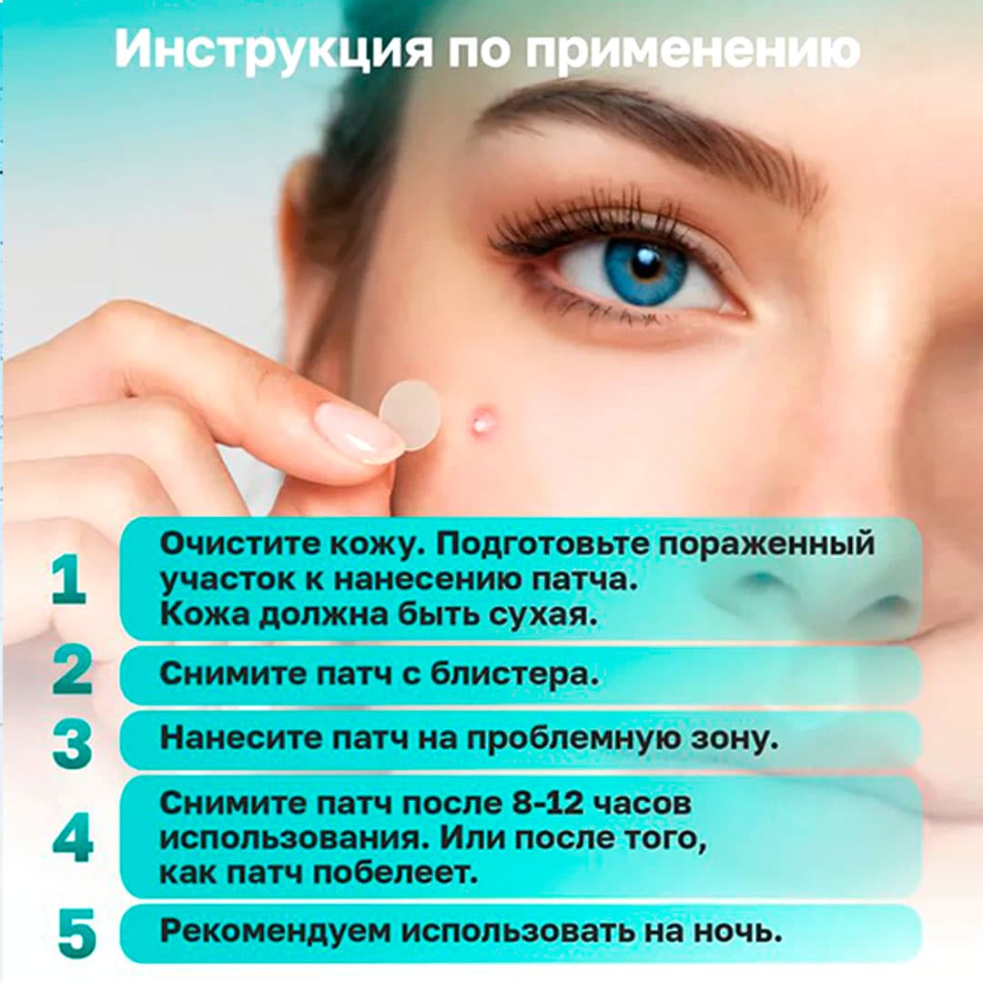 Патчи от акне